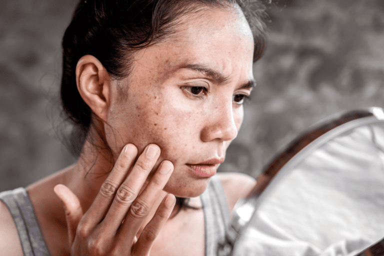 How to Remove Dead Skin from Face – Glow Up Guide
