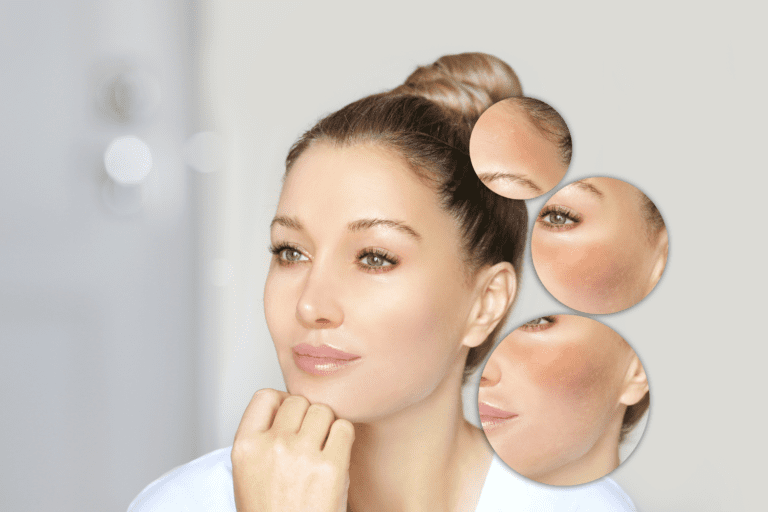 Signs of Damaged Skin Barrier
