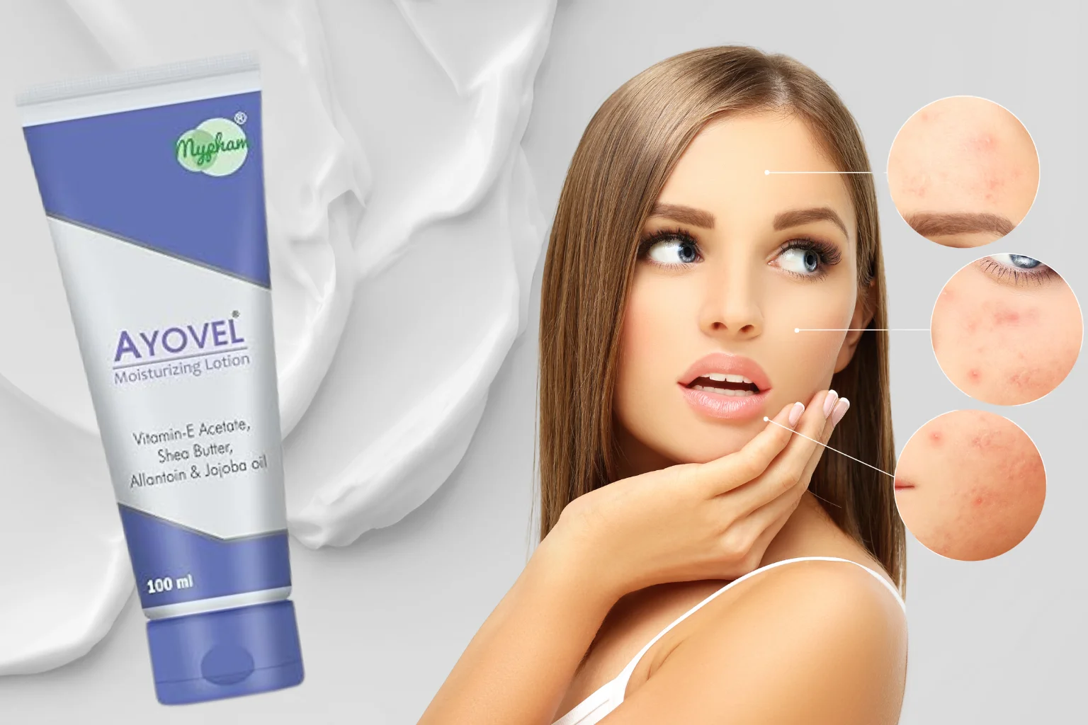 Which Moisturizer is Best for Acne Prone Skin – Clear Skin Ahead